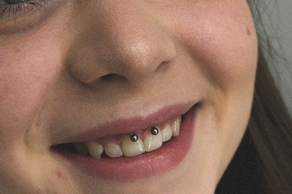Smile-Piercing