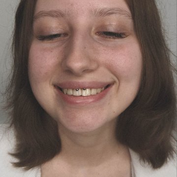 Smile-Piercing