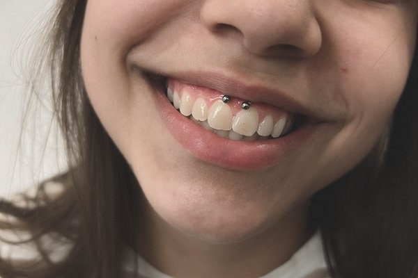 Smile-Piercing